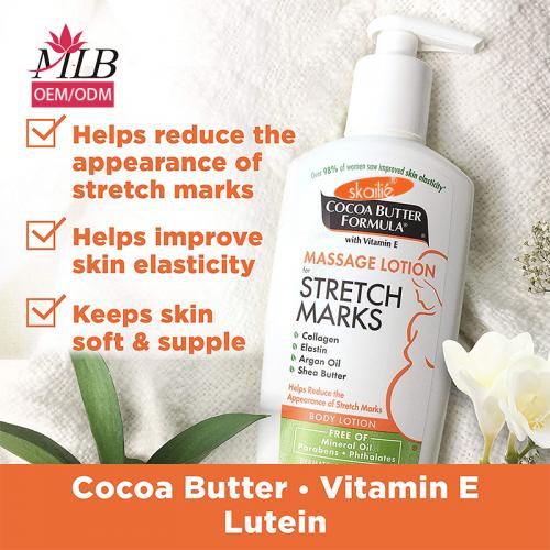 Dehnungsstreifen Bodylotion