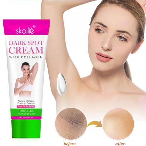 Collagen-Creme zur Entfernung dunkler Flecken